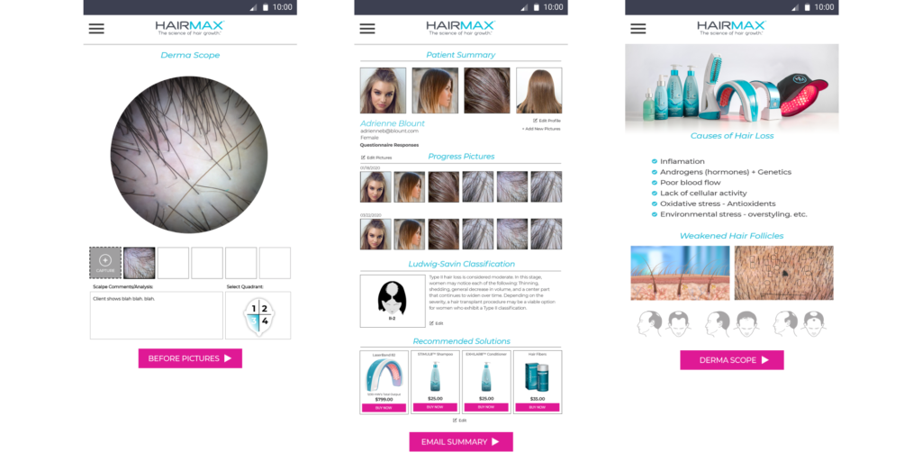 UppLabs created Healthcare app for preventing hair loss. Dermatoscope and hair loss classification